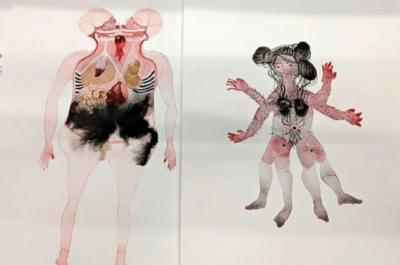 Art based on medical and historical representations of female bodies